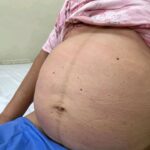 Seis de cada 10 muertes maternas en Tamaulipas ocurrieron sin atención prenatal